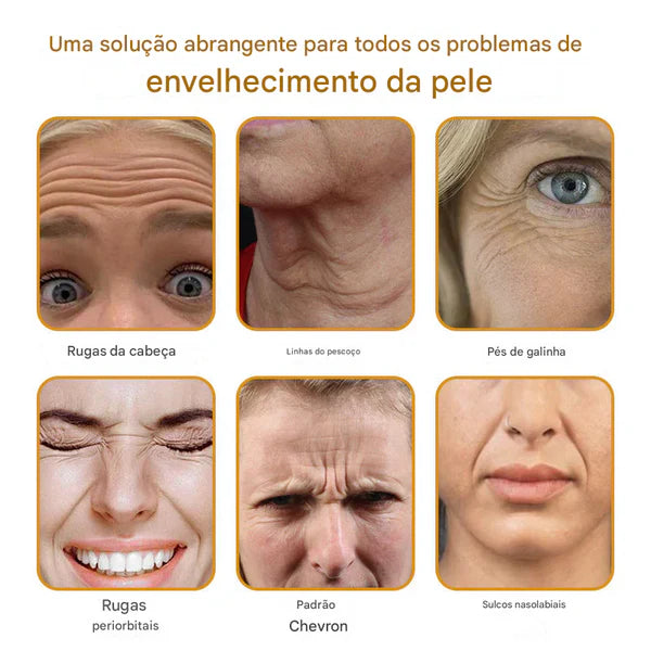 Creme removedor de rugas Botox Bee Venom - 🐝 Promoção relâmpago: só hoje!
