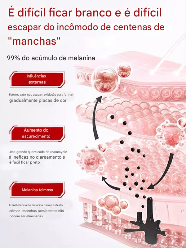 【Todos os tipos de manchas podem ser removidos com um único spray】 Água de beleza clareadora e removedora de imperfeições