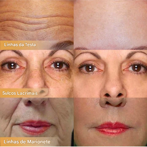 [Queima de Estoque🔥] Compre 1 Leve 2 Creme Facial Reafirmante com Polipeptídeos — Transforme Sua Pele em 1 Semanas