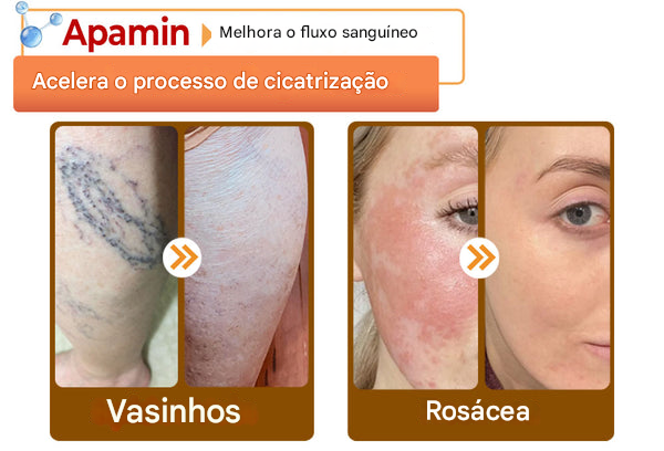 LOVILDS™ Creme Tudo-em-Um com Veneno de Abelha – Aprovado por Dermatologistas dos EUA