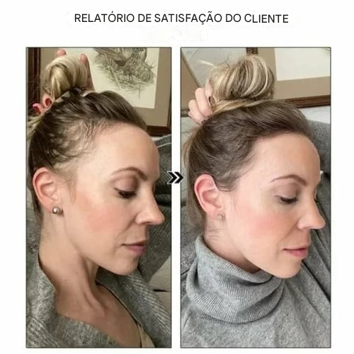 Último dia de promoção: 70% de desconto – 🔥VitaStrands Sérum para Crescimento Capilar